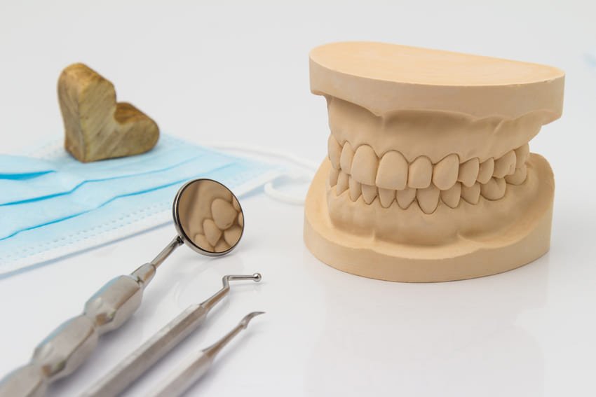 Platre d'une dentition d'un patient